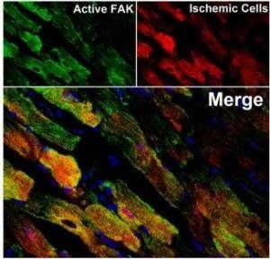 Following heart attack, heart cells are stressed due to lack of oxygen. When SuperFAK (in green) is expressed in the heart, it is further activated and protects heart cells from oxidative stress (in red). (Credit: Image courtesy of University of North Carolina School of Medicine)