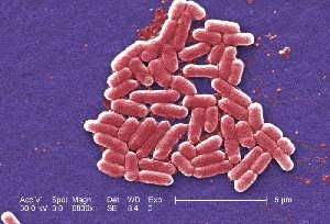 Escherichia coli bacteria. (Credit: Janice Haney Carr)