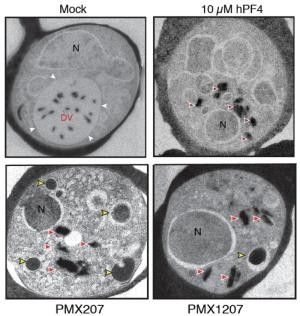 Transmission electron micrograph images reveal lysis of the parasite digestive vacuole (DV) upon treatment with human PF4 (top right), or the small molecules PMX207 and PMX1207 (bottom) as shown by the dispersal of hemozoin fragments throughout the cytoplasm (red arrowheads) and undigested hemoglobin-containing vesicles (yellow arrowheads). Mock-treated control (top left) shows complete integrity of the DV membrane (white arrowheads), encapsulating all hemozoin crystals. (N: parasite nucleus).