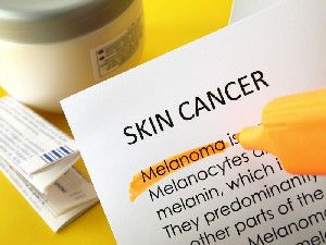 Researchers identified odorants from human skin cells that can be used to identify melanoma, the deadliest form of skin cancer. (Credit: (c) alejandro dans / Fotolia)
