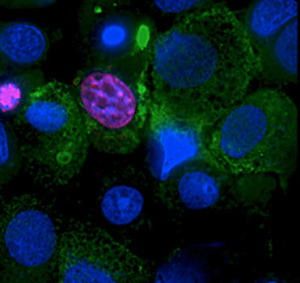 Scientists have found a way to make insulin-producing cells, pictured above in fluorescent blue, multiply in the laboratory. This may allow clinicians to treat more patients who have type 1 diabetes with transplants of the cells. (Credit: Haytham Aly, PhD)