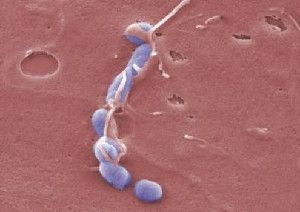 Yersinia (in blue) cause serious infections. (Credit: HZI/Manfred Rohde)