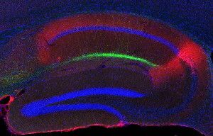 This cross-section of the hippocampus shows island cells (green) projecting to the CA1 region of the hippocampus. (Credit: Takashi Kitamura)