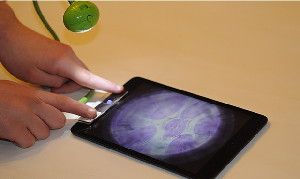 A magnified image is displayed on an iPad screen.