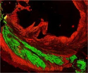 This image shows an implanted graft of cardiac cells derived from human stem cells (green) meshed and beat with primates' heart cells (red).