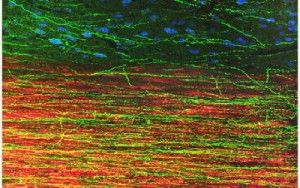 This image depicts extension of human axons into host adult rat white matter and gray matter three months after spinal cord injury and transplantation of human induced pluripotent stem cell-derived neurons. Green fluorescent protein identifies human graft-derived axons, myelin (red) indicates host rat spinal cord white matter and blue marks host rat gray matter.