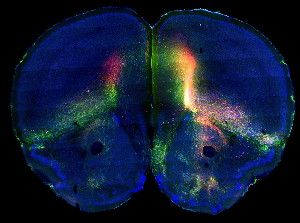 Fluorescent dyes trace two different pathways in the mouse brain, part of a new map of connectivity in the mammalian cortex