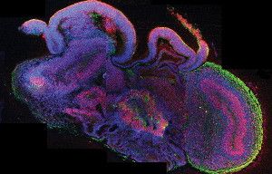 A cross section of a lab-grown approximation of a human brain reveals several features, including neurons (green) and neuron-producing stem cells (red).