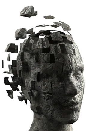 Alzheimer's image
