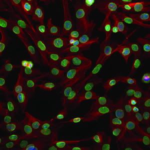CROWD OF CELLS: Mouse fibroblasts stained for lamina (green), tubulin (red) and DNA (blue)