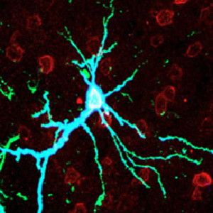 A neuron in a rat brain's cortex over-expressing PKMzeta (blue).