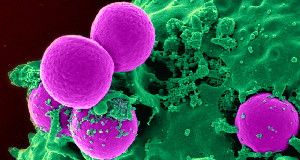 WORSE THAN EVER &nbsp;Staphylococcus aureus microbes resistant to the drug methicillin,shown being attacked by an immune cell (green) in this micrograph, are among many bacteria becoming more prevalent, WHO reports.