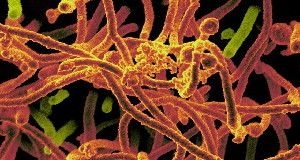 REGULAR RATE &nbsp;A genetic analysis suggests that the Ebola virus, shown here in orange, is not evolving as fast as expected.