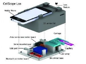 This is a schematic of the CellScope Loa device, a mobile phone-based video microscope. The device includes a 3-D-printed case housing simple optics, circuitry and controllers to help process the sample of blood. CellScope Loa can quantify levels of the Loa loa parasitic worm directly from whole blood in less than 3 minutes.