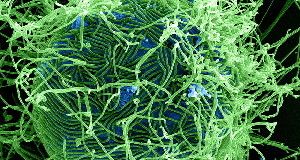 Ebola virus particles (green) bud from an infected cell (blue). The virus has infected more people in Liberia.
