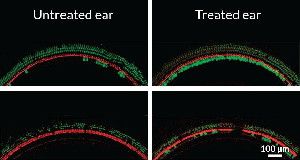SAVING CELLS &nbsp; A mutation causes sound-sensing cells (bright green) to die off quickly in deaf mice, but gene therapy can rescue these cells (right) in mice given a virus that delivers a working gene. Two inner ear locations are shown.