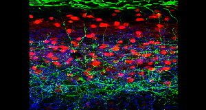 UP TO SCRATCH &nbsp;A group of nerve cells in the spinal cord of a mouse (red) curb mechanical itch, a new study suggests. 