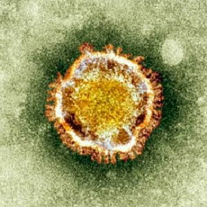 The research legacy of the SARS virus (pictured) is helping scientists to move quickly against a new threat.