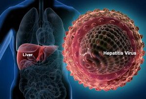 hepatitis C